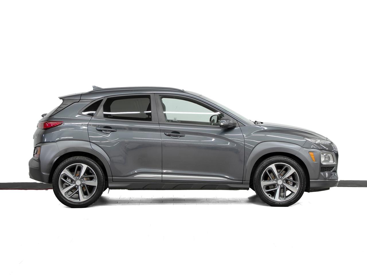 2021 Hyundai KONA ULTIMATE AWD | Nav | Leather | Sunroof | CarPlay