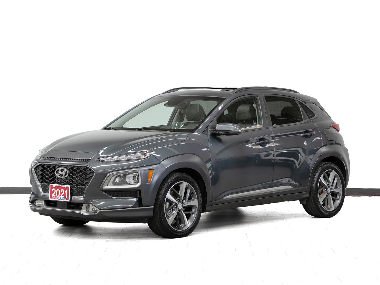 2021 Hyundai KONA ULTIMATE AWD | Nav | Leather | Sunroof | CarPlay