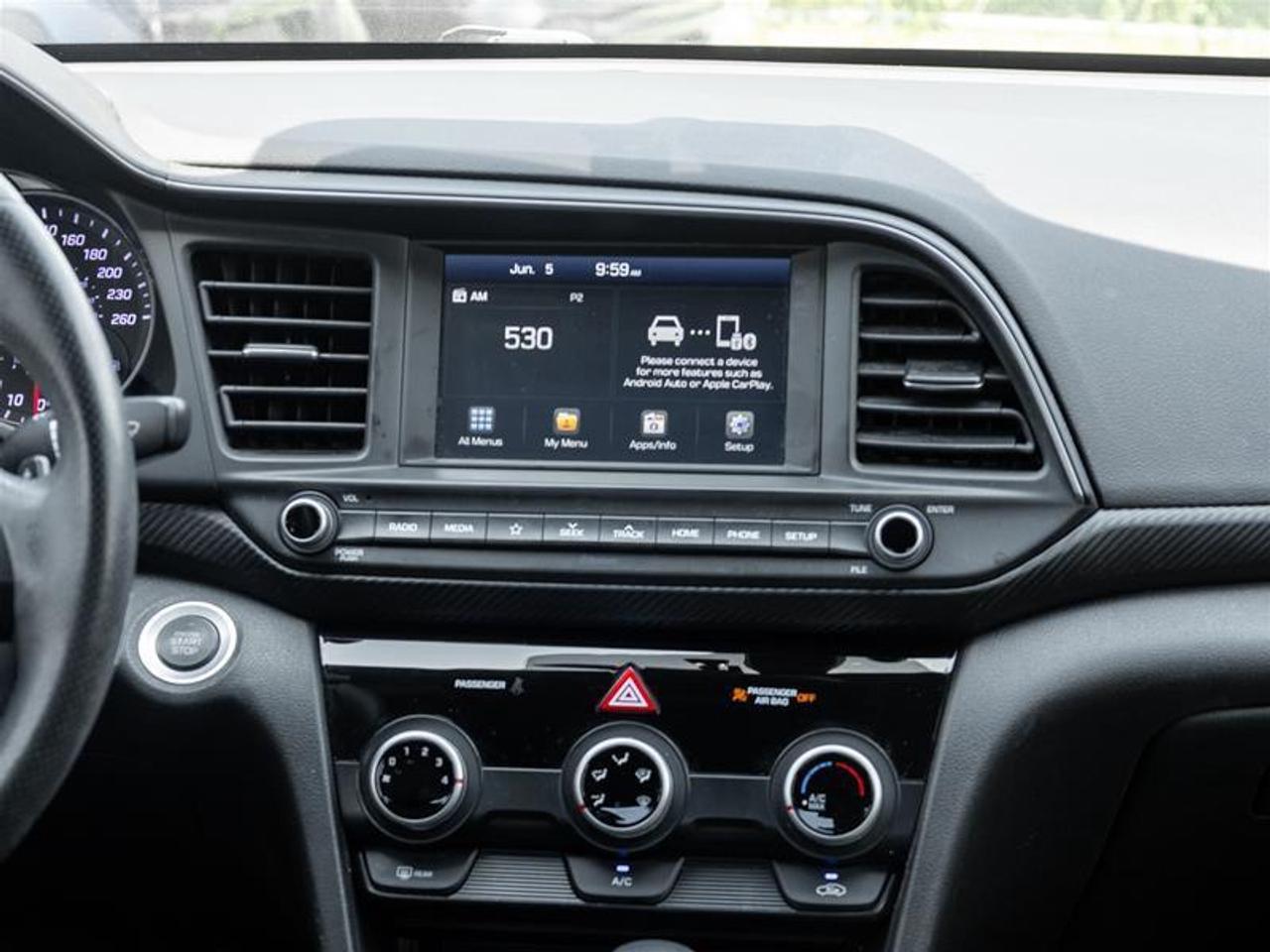 2020 Hyundai Elantra SPORT 4dr Sedan Photo