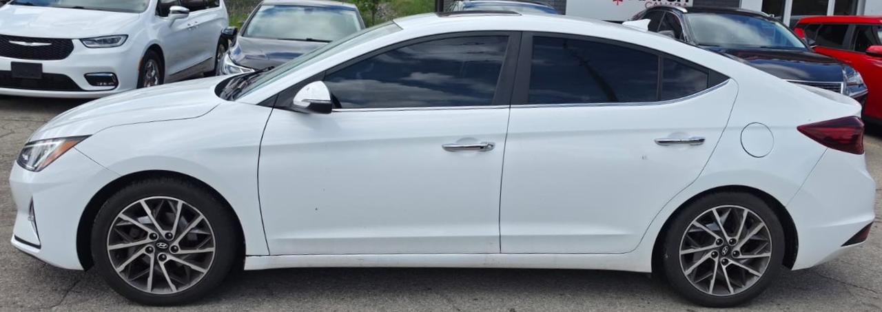 2020 Hyundai Elantra LUXURY / LEATHER / ROOF / BLINDSPOT / HTD SEATS Photo