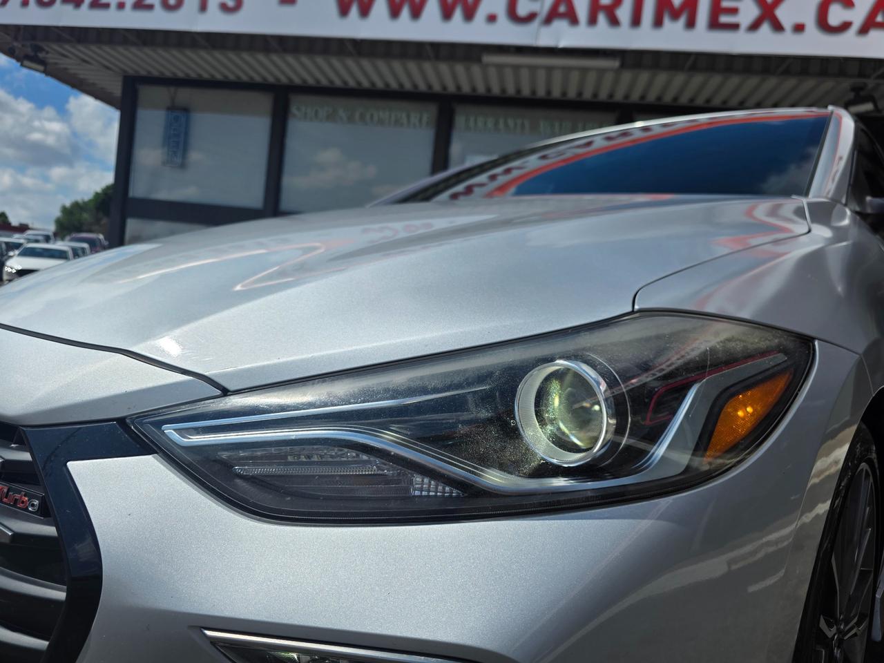 2018 Hyundai Elantra Sport Tech LOADED | ONE OWNER | ACCIDENT FREE | LOW KMS Photo