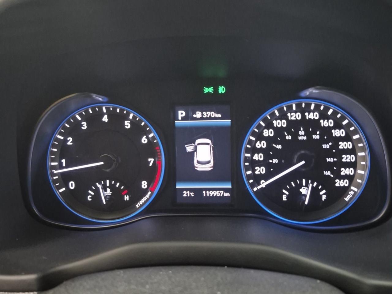 2018 Hyundai KONA Ultimate FWD - NO ACCIDENTS | ONE OWNER Photo4