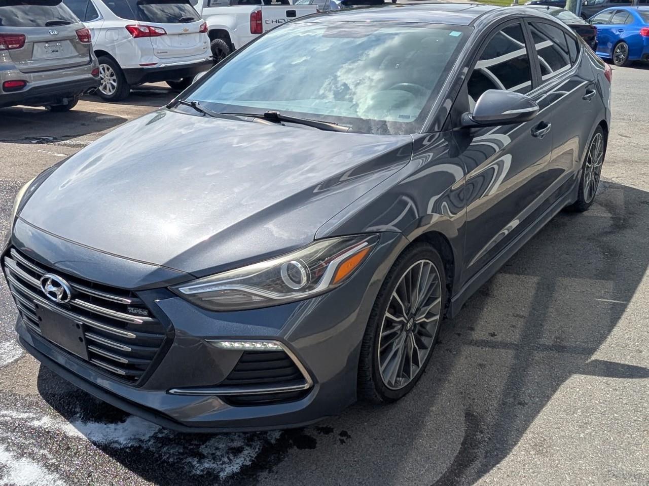2018 Hyundai Elantra Sport Photo0