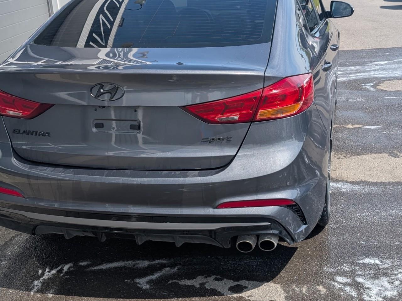 2018 Hyundai Elantra Sport Photo