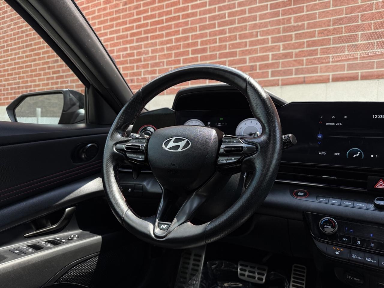 2025 Hyundai Elantra N Line Ultimate|One Owner|Clean Carfax Photo