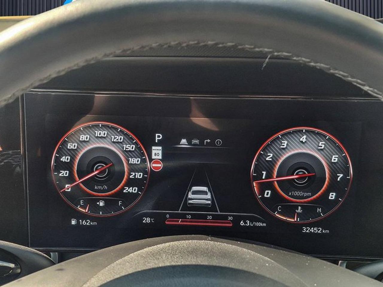 2025 Hyundai Elantra Luxury | Leather | Sunroof | Heated Seats + Steering | Remote Start | Adaptive Cruise | and More! Photo