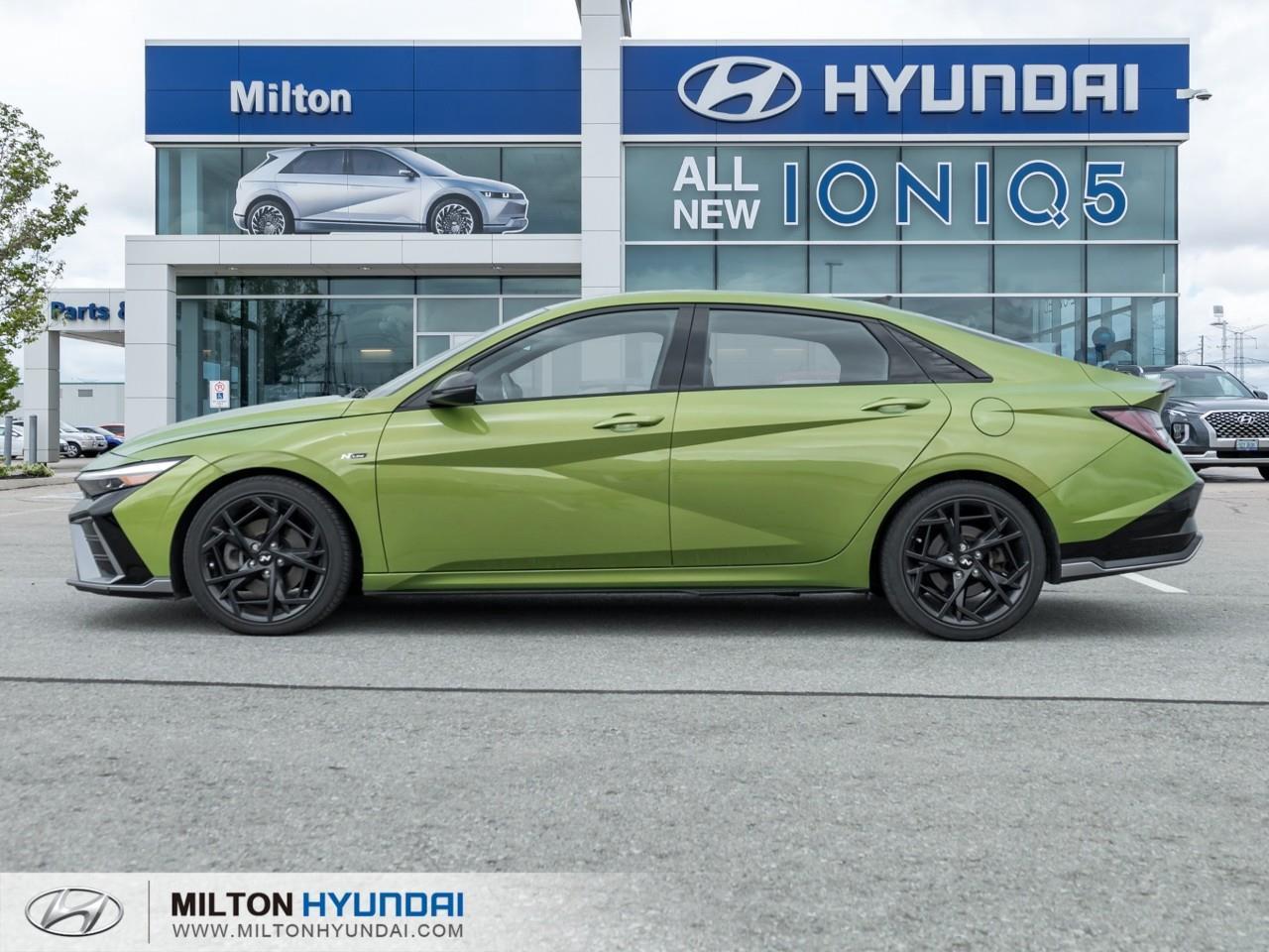 2024 Hyundai Elantra N Line Ultimate 4dr Sedan Photo2