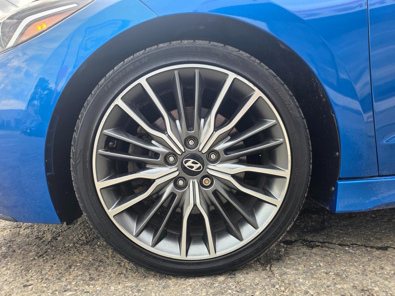 2017 Hyundai Elantra Sport MANUAL | 1.6T | Leather | Sunroof | Navigation | BSM Photo