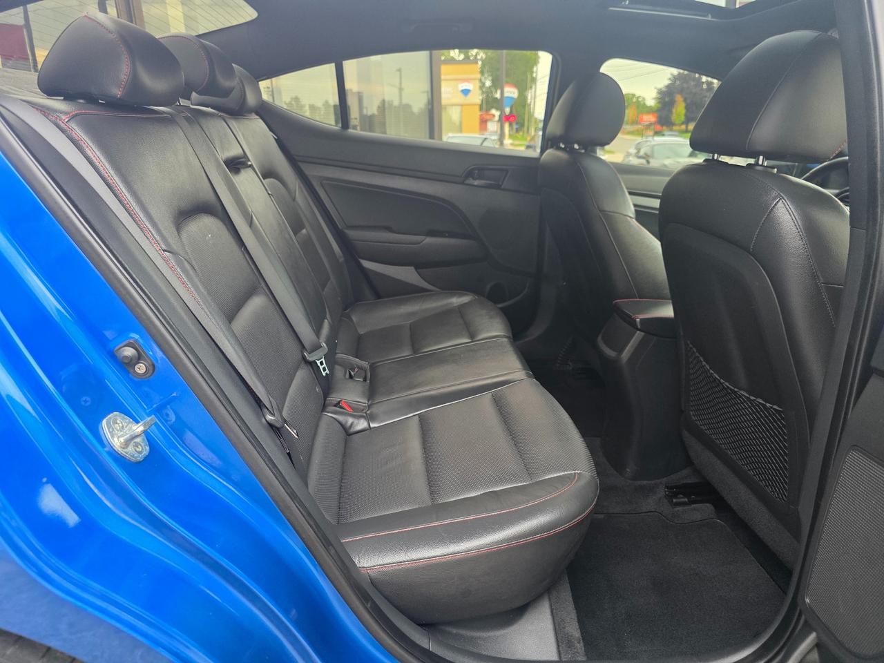 2017 Hyundai Elantra Sport MANUAL | 1.6T | Leather | Sunroof | Navigation | BSM Photo