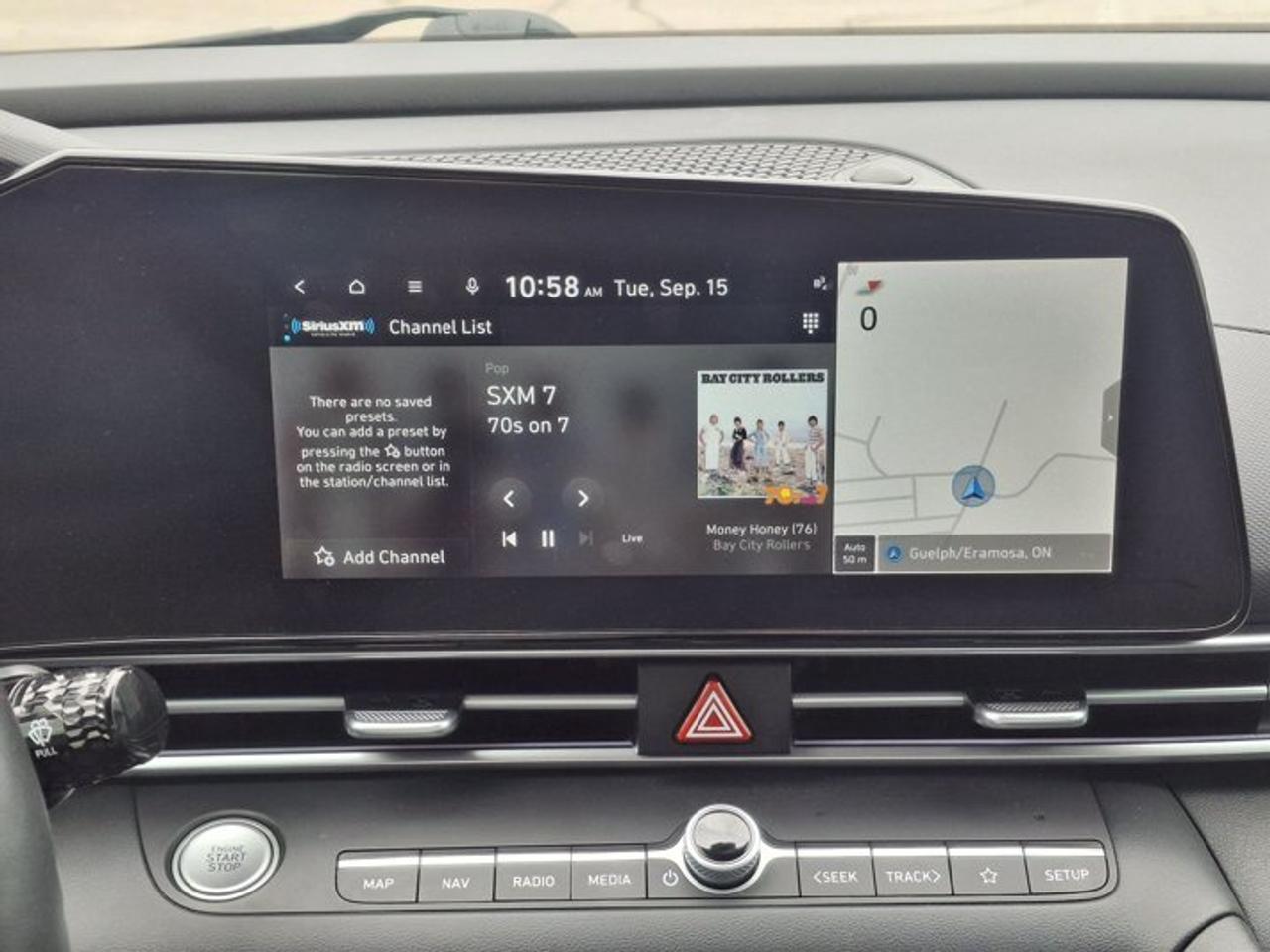 2024 Hyundai Elantra Luxury | Leather | Sunroof | Heated Seats + Steering | Remote Start | CarPlay + Android | and More ! Photo