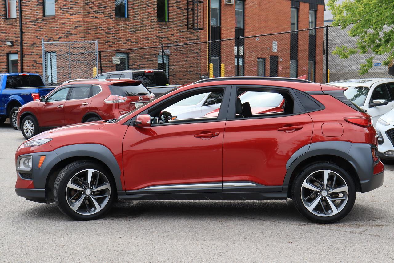 2020 Hyundai KONA Ultimate | AWD | Leather | Roof | Nav | Cam | BSM Photo6
