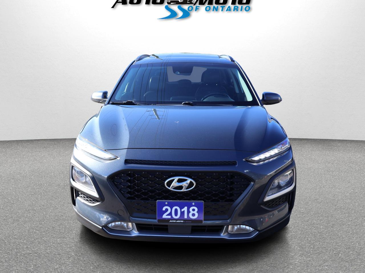 2018 Hyundai KONA LUXURY AWD *ACCIDENT FREE*1 OWNER* CAMERA BLUETOOTH LEATHER HEATED SEATS CRUISE ALLOYS Photo1