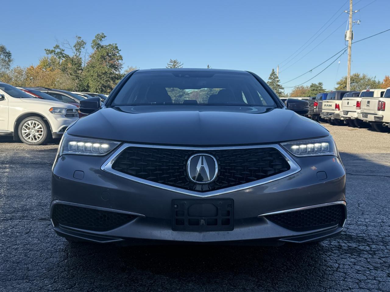 2018 Acura TLX Sh-Awd Tech Sedan Photo