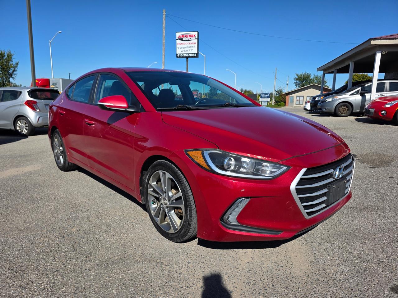 2017 Hyundai Elantra GLS (A6) 4dr Sedan Photo0