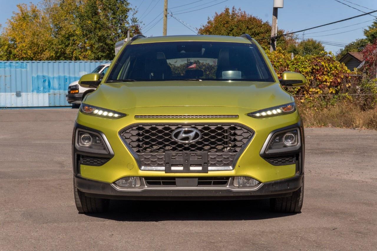 2020 Hyundai KONA 1.6T Ultimate AWD w/Lime Colour Pack Photo