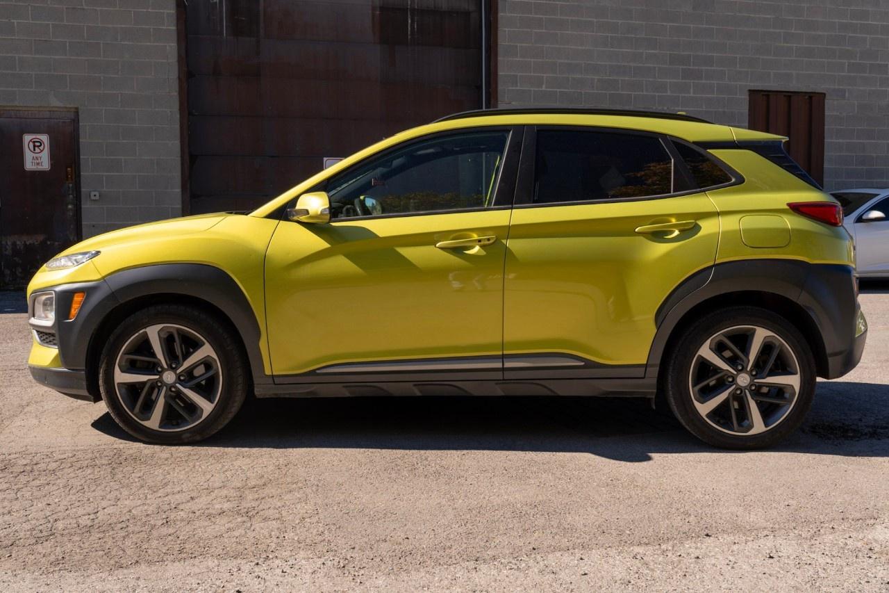 2020 Hyundai KONA 1.6T Ultimate AWD w/Lime Colour Pack Photo