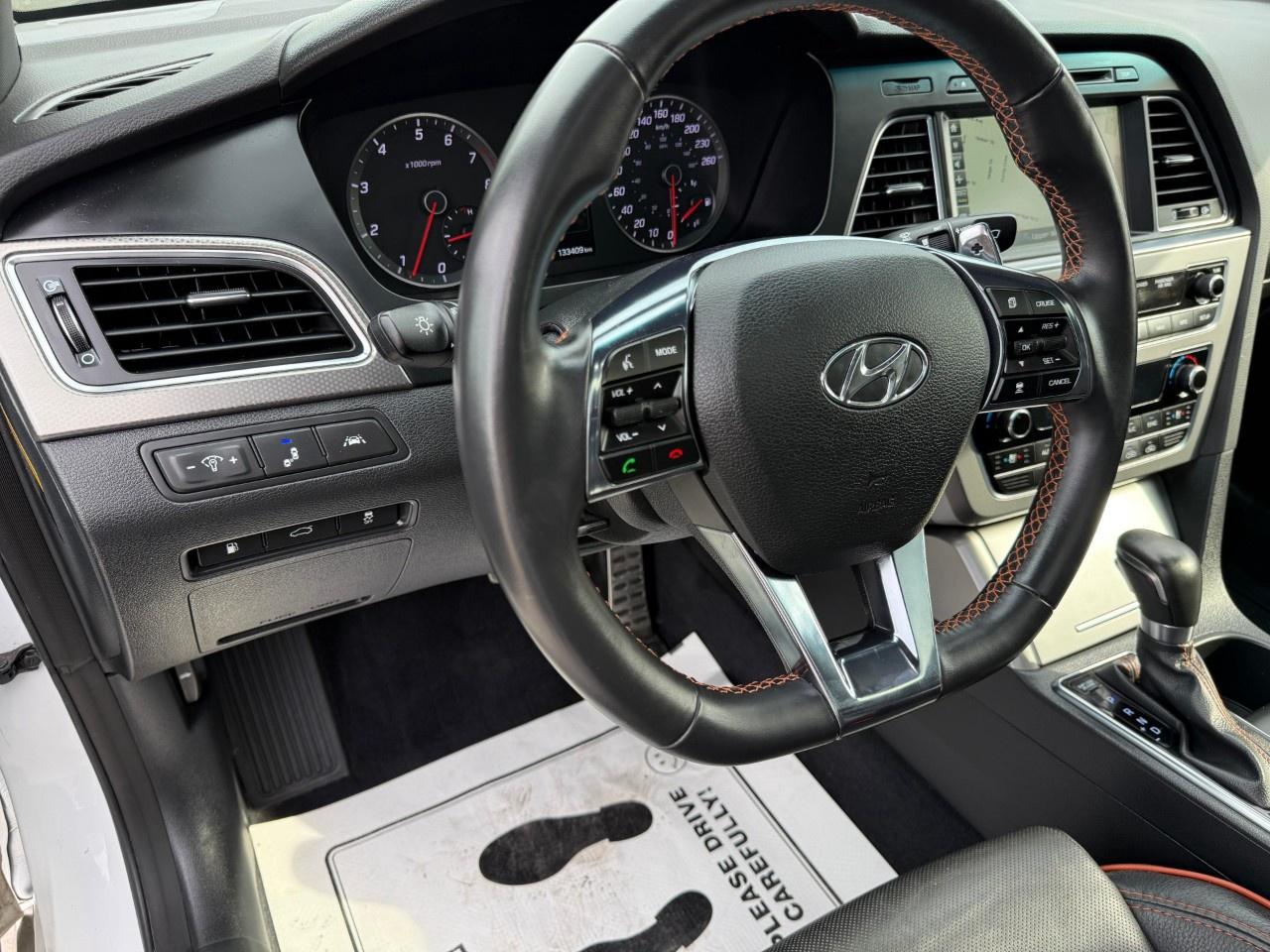 2015 Hyundai Sonata 4dr Sdn 2.0T Auto Ultimate w/Colour Pack Photo