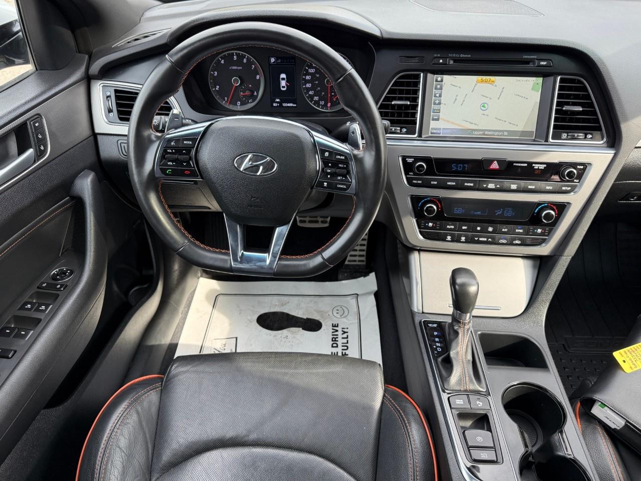2015 Hyundai Sonata 4dr Sdn 2.0T Auto Ultimate w/Colour Pack Photo