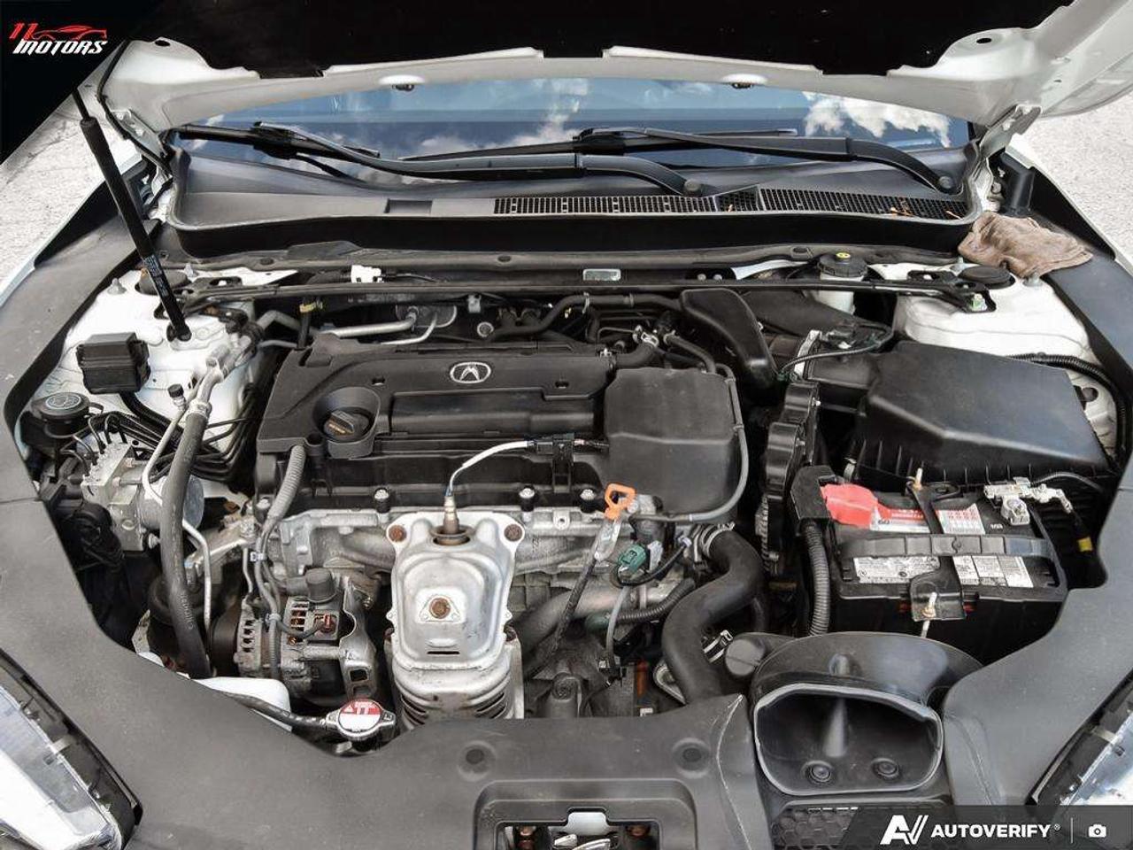 2018 Acura TLX Tech Sedan   LOADED   CERTIFIED Photo