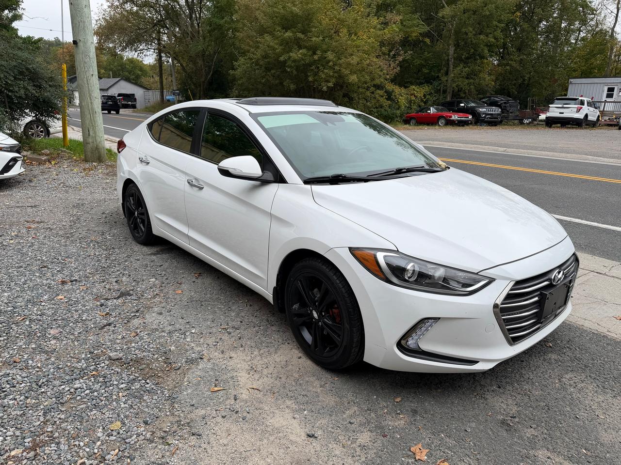 2017 Hyundai Elantra Limited ULTIMATE - Photo #3