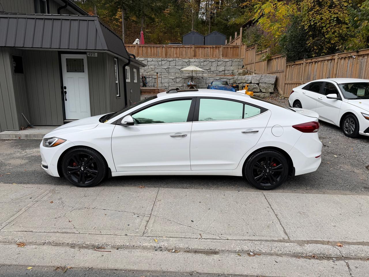 2017 Hyundai Elantra Limited ULTIMATE Photo