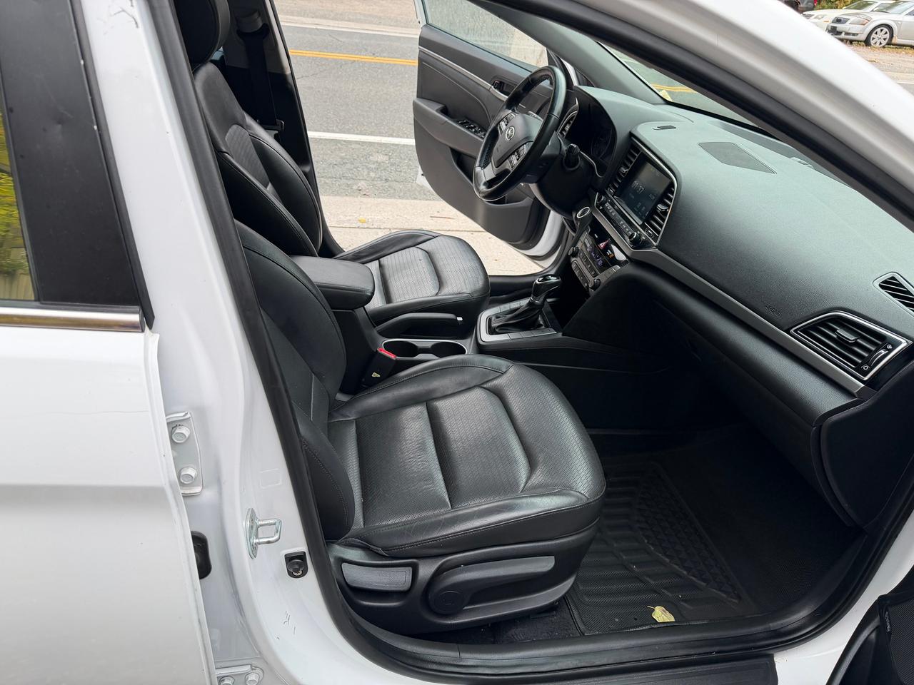 2017 Hyundai Elantra Limited ULTIMATE Photo