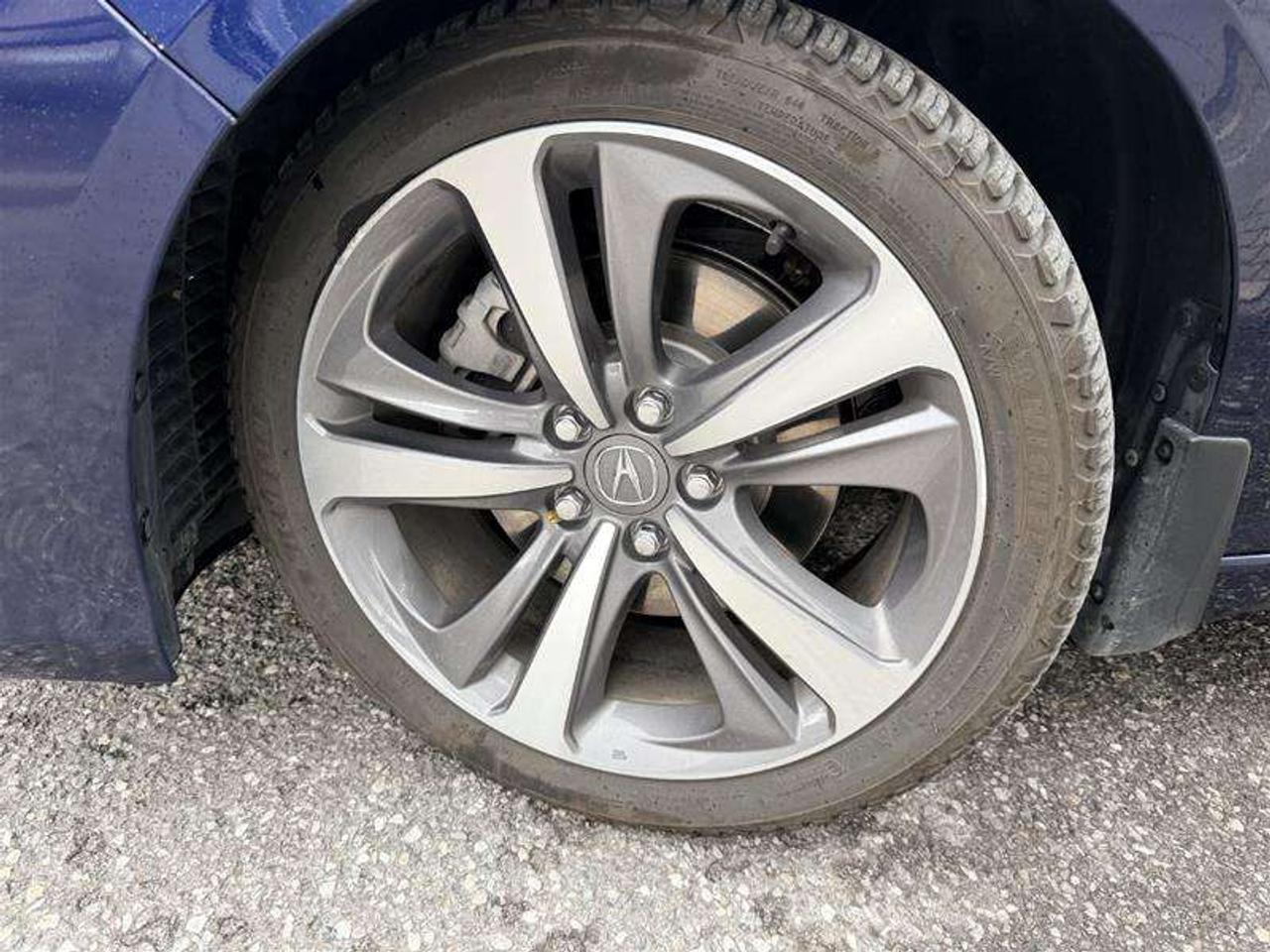 2021 Acura TLX AWD   360 Camera Photo