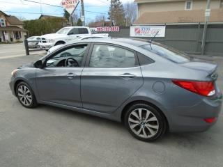 2017 Hyundai Accent SE - Photo #5