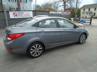 2017 Hyundai Accent SE - Photo #6