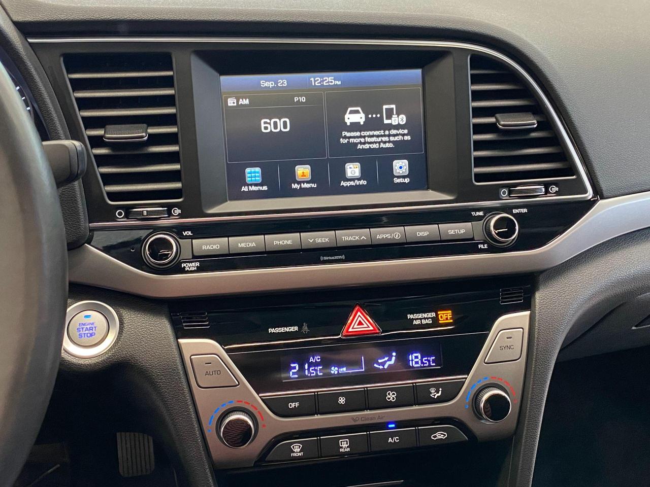 2017 Hyundai Elantra GLS+Sunroof+ApplePlay+Camera+CLEAN CARFAX Photo80
