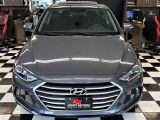 2017 Hyundai Elantra GLS+Sunroof+ApplePlay+Camera+CLEAN CARFAX Photo73