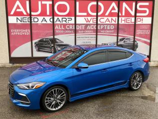 Used 2018 Hyundai Elantra Sport Tech-ALL CREDIT ACCEPTED for sale in Toronto, ON