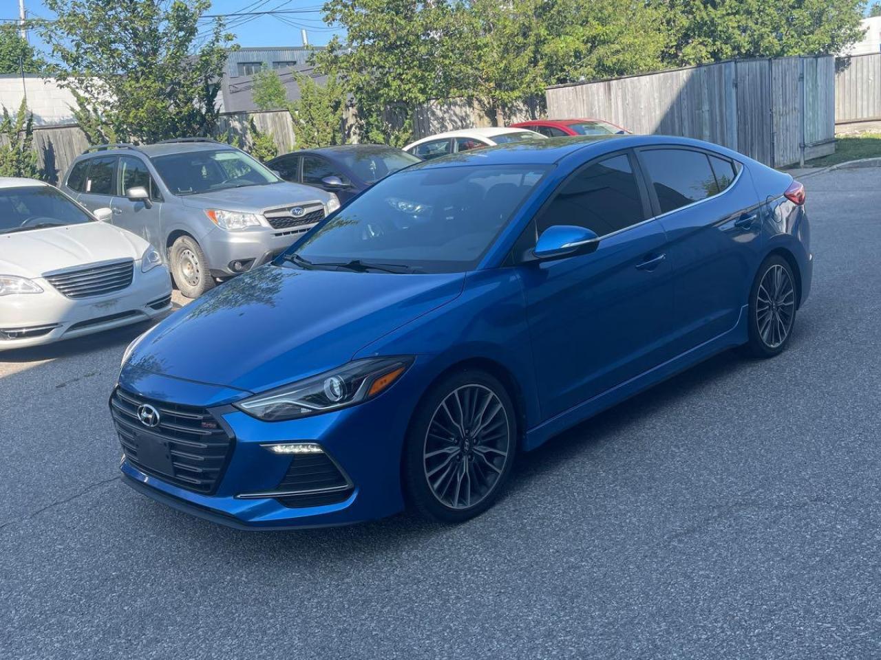 Used 2018 Hyundai Elantra LEATHER SUNROOF H-SEATS MINT WE FINANCE ALL CREDIT for sale in London, ON