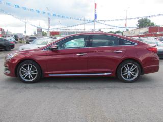 Used 2015 Hyundai Sonata NAV LEATHER SUNROOF MINT! WE FINANCE ALL CREDIT! for sale in London, ON