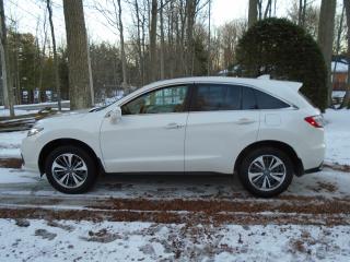 2017 Acura RDX AWD 4dr Elite Pkg - Photo #8