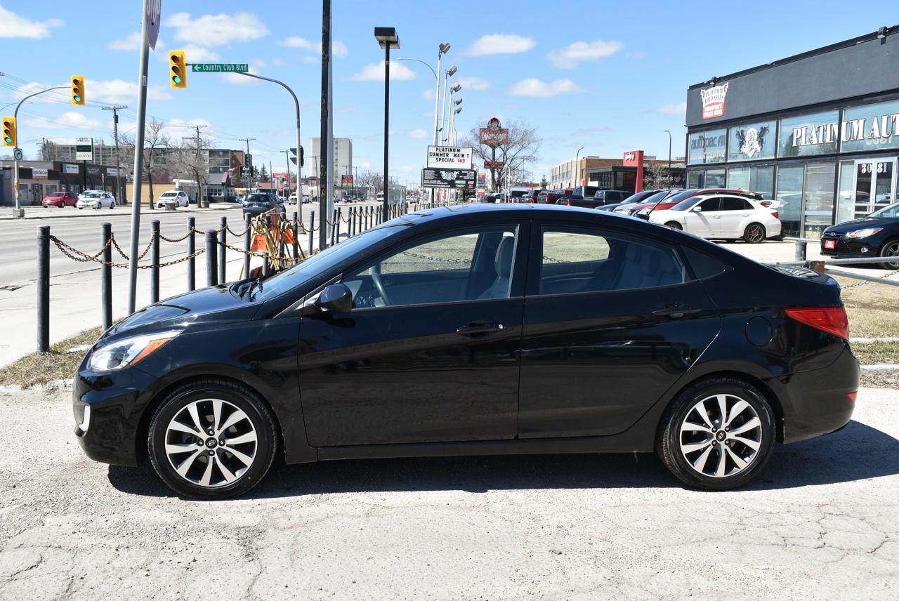 2017 Hyundai Accent SE - Photo #3