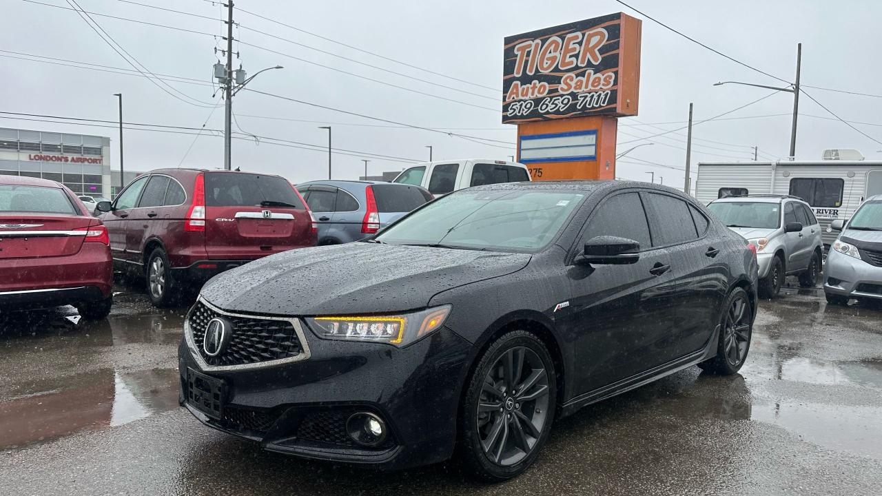 2020 Acura TLX A-SPEC*ONLY 49,000KMS*LEATHER*TECH*LOADED*CERT